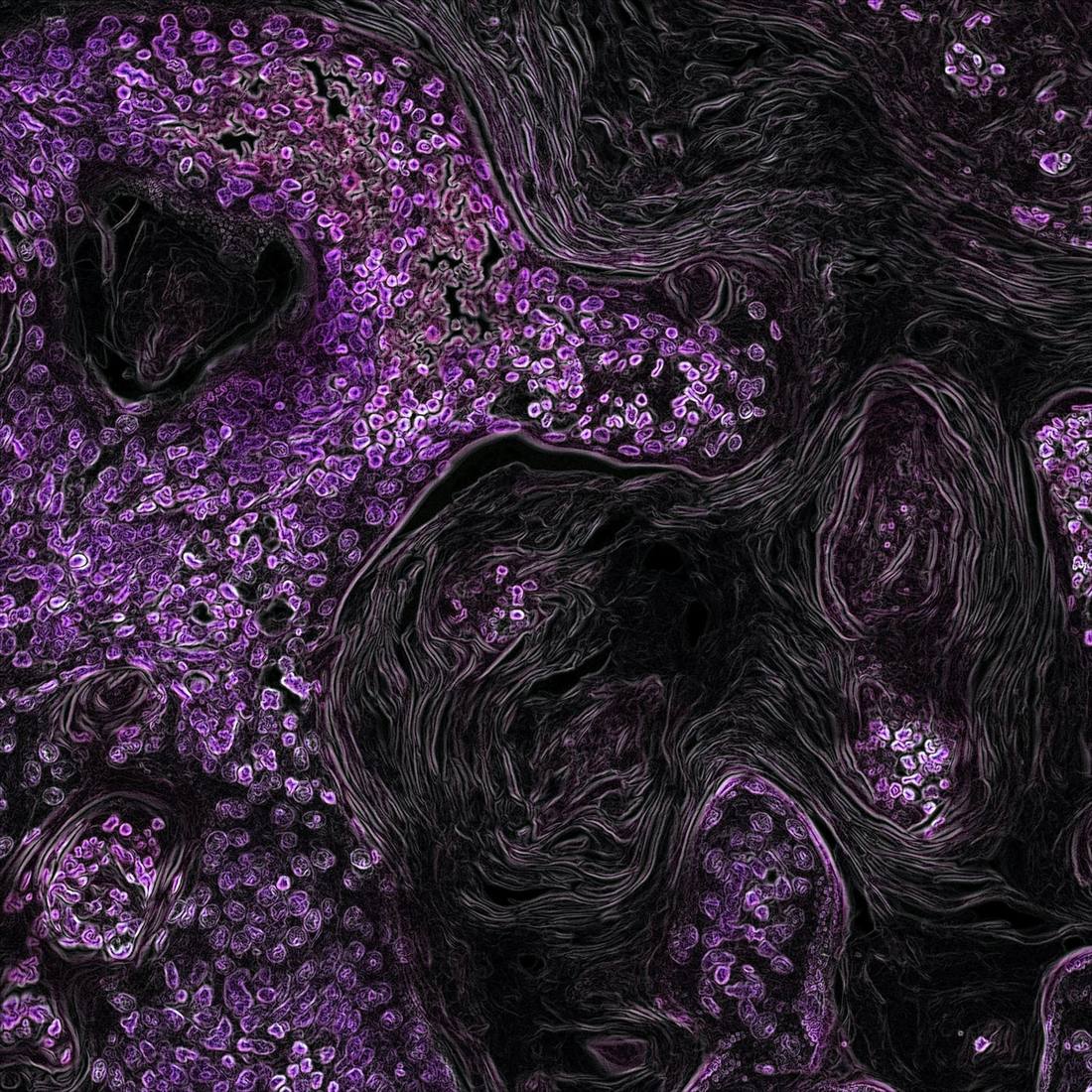 False-colour microscopy image of tissue with purple-stained cells