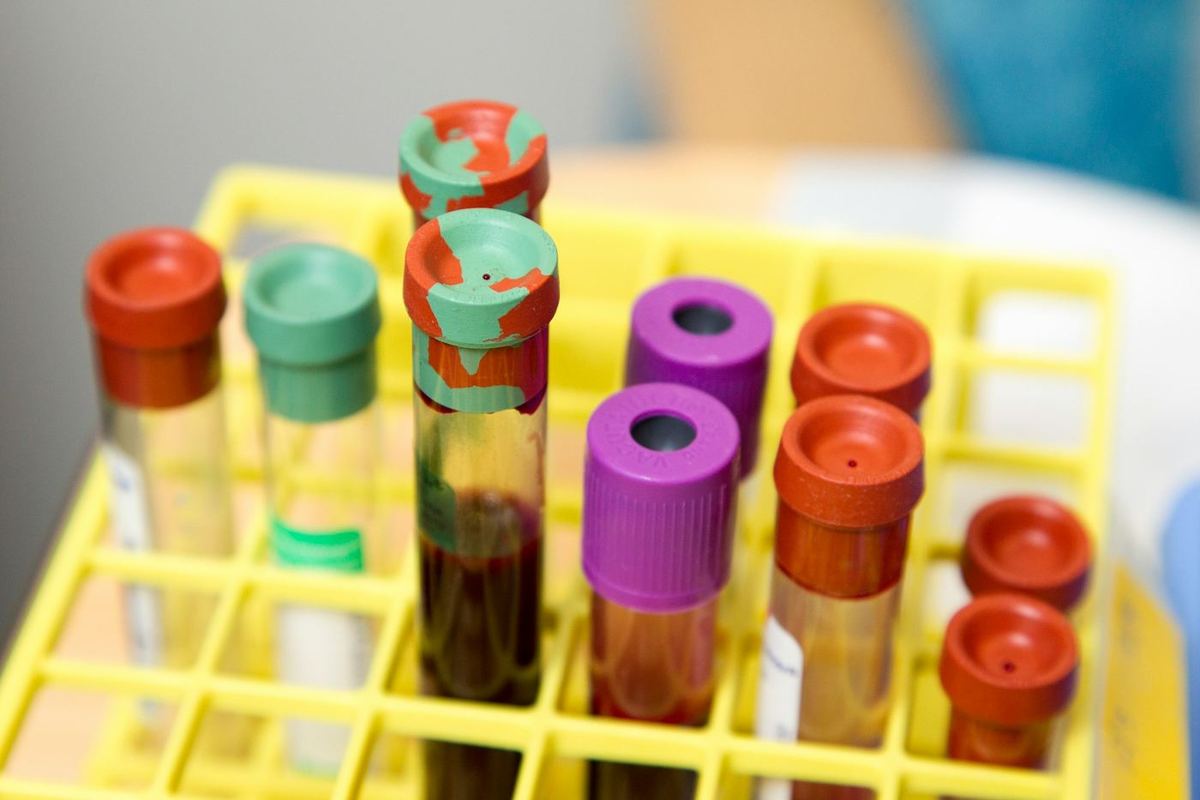 Blood collection tubes with coloured caps in a yellow rack