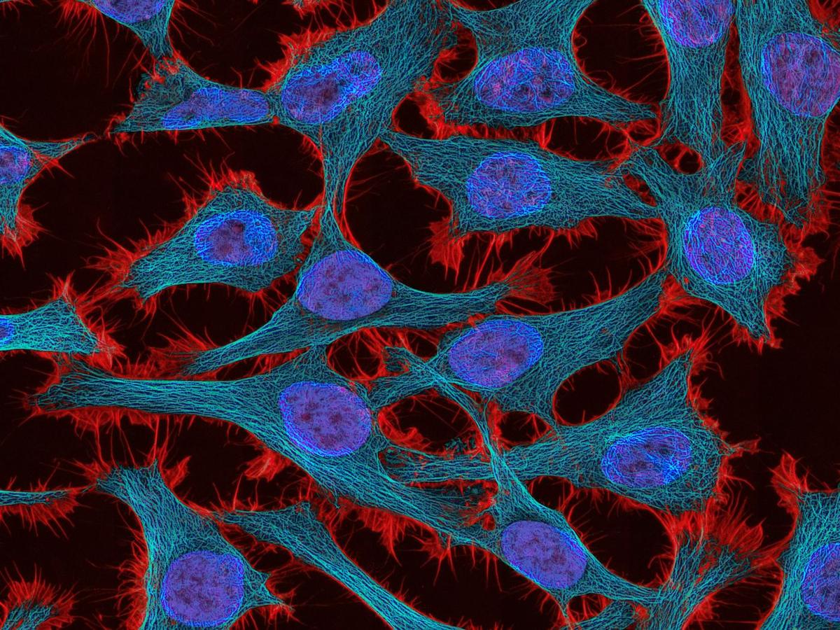 Fluorescence microscopy image of cells with blue nuclei and red and teal cytoskeleton